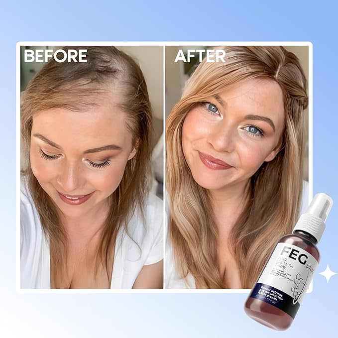 1.	FEG Plus Hair Growth Spray – Advanced Hair & Scalp Treatment with Anagain & Procapil | 50ml